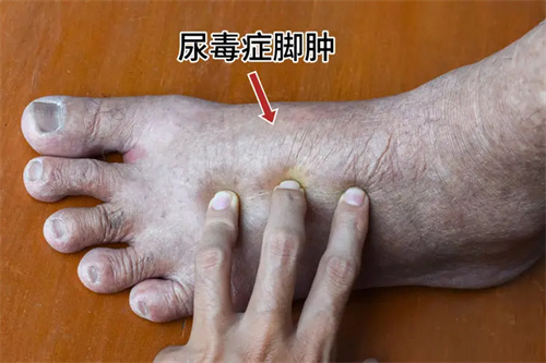 图片细节